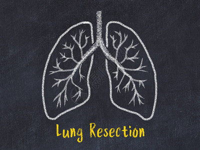 学习医学的概念肺切除术的粉笔画图片