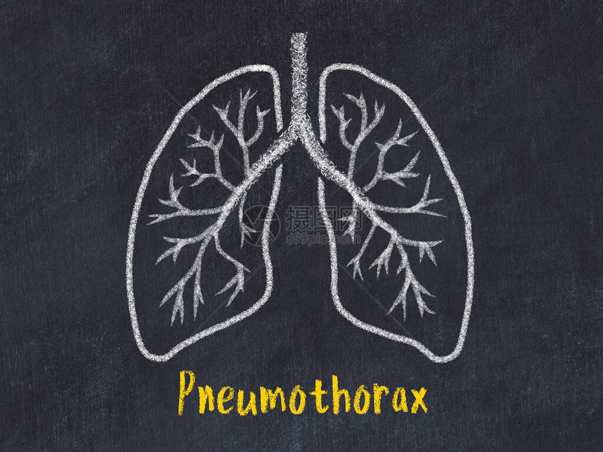 学习医学的概念用粉笔画肺上面写着气胸图片