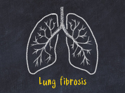 学习医学概念肺部切片抽取并图片