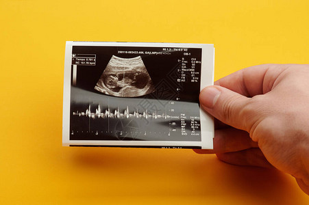 检查未来婴儿心脏跳动通图片
