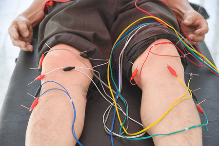 人类在膝盖和腿部恢复电击以缓解疼痛图片