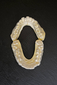 人下巴上的牙膏未来植入物的牙齿的石图片