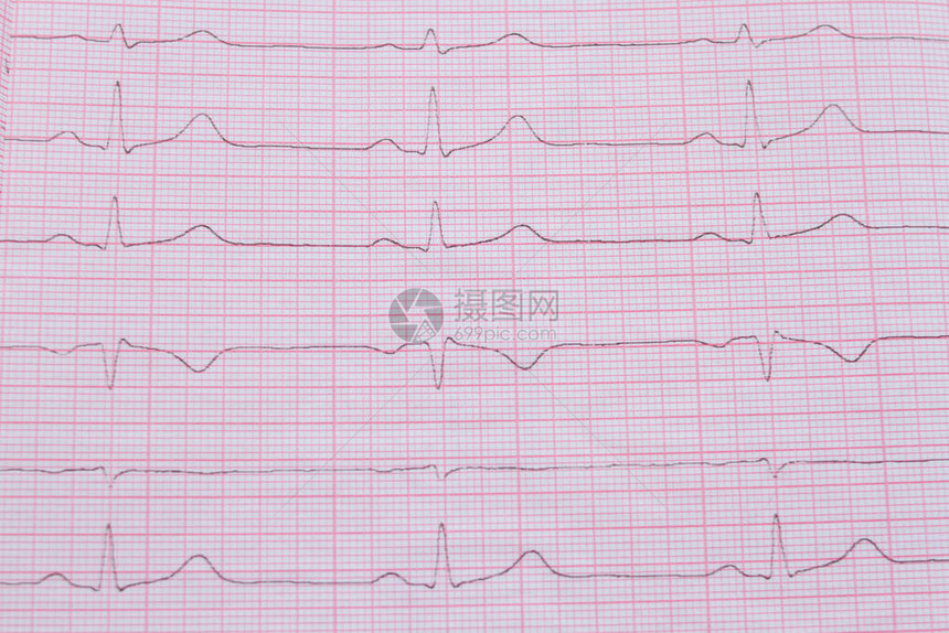 在纸上贴近ECG心电图脉冲图图片
