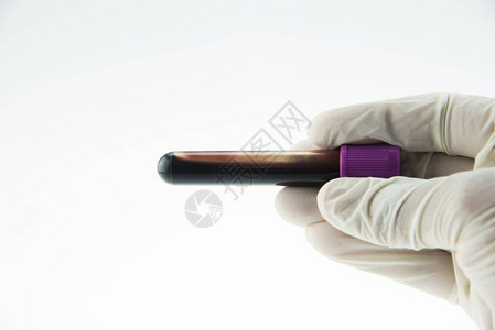 用于实验室中CBC测试的真空采集血液管图片