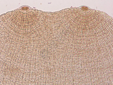 在显微镜100x下海藻的二缺图片