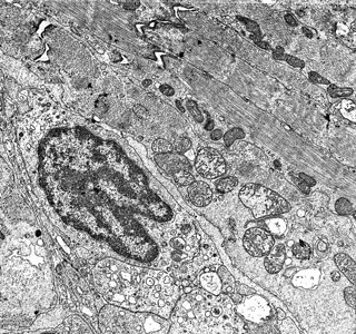 电子显微镜下的细胞核和风琴5图片