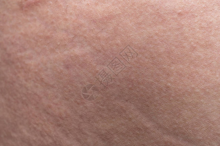 人体健康皮肤照背景图片