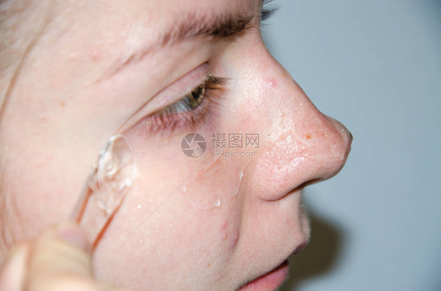 一位欧洲女孩正在将韩国化妆品涂在她的面膜上清洁毛孔油脂粉刺皱纹一个有皮肤问题的女孩的特写脸摩丝喷雾面部磨砂和洗面奶图片