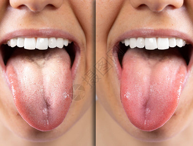 一个白人女孩舌头的前后视图背景图片