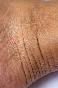 脚踝上的妇女皮肤干燥近身和宏观镜头亚洲身体皮肤部分保健概图片