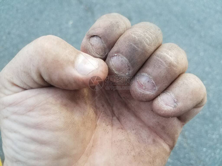 一只脏手脏兮的指甲被咬得令人作呕图片