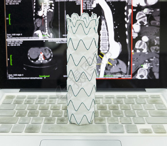 血管内支架移植物图片