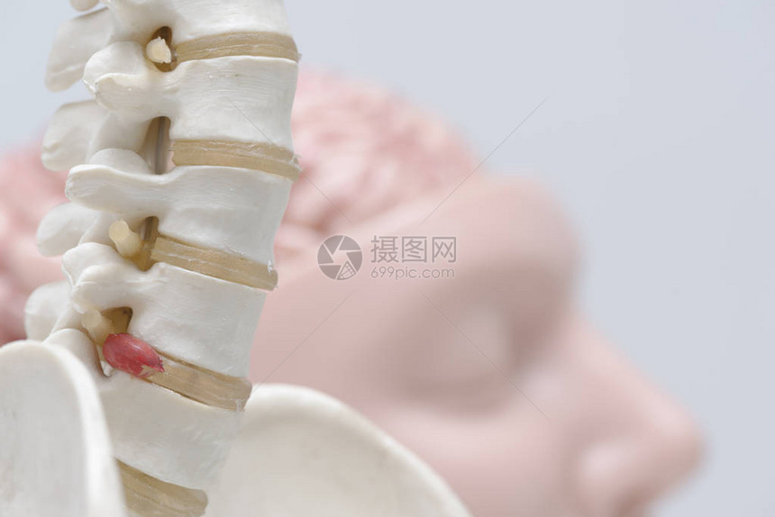 卢巴脊椎模型和人脑模型人工外壳间脊椎图片