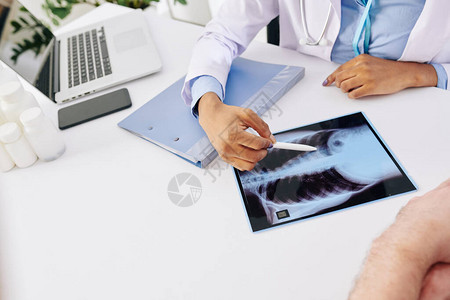 在解释肿瘤的病人位置时用胸部X射线指胸部女图片