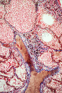 显微镜下的肺结核组背景图片
