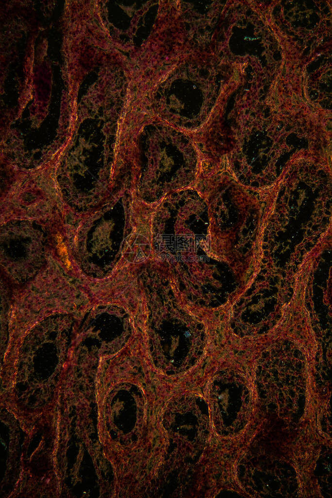 显微镜下的内阴睾丸组图片