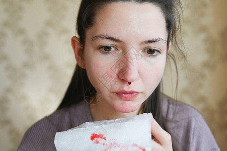 严重流鼻血的白种女人的画像患有严重疾图片