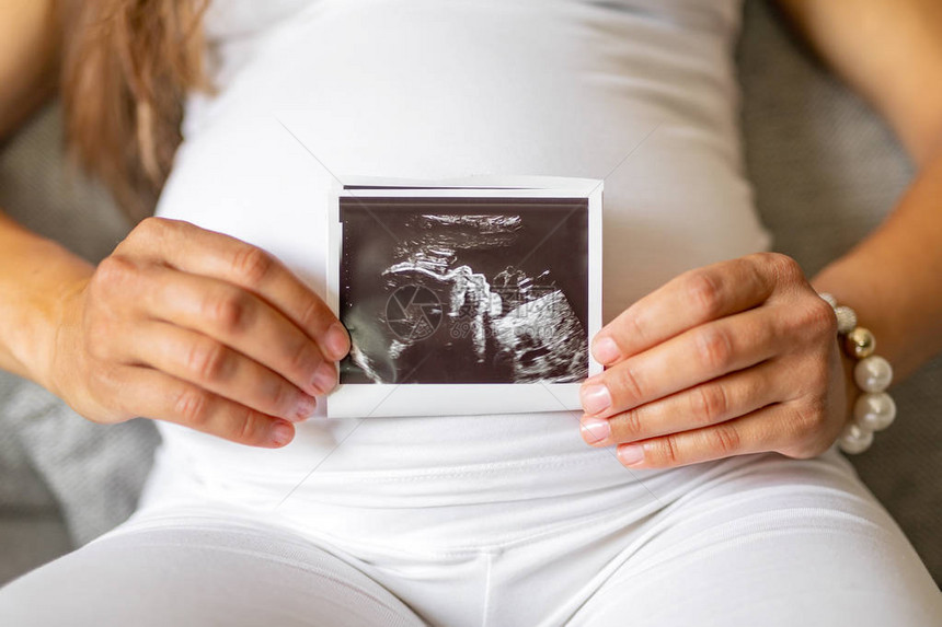 一名孕妇被贴上超声波照片图片