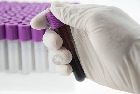EDTA血液管用于实验室图片