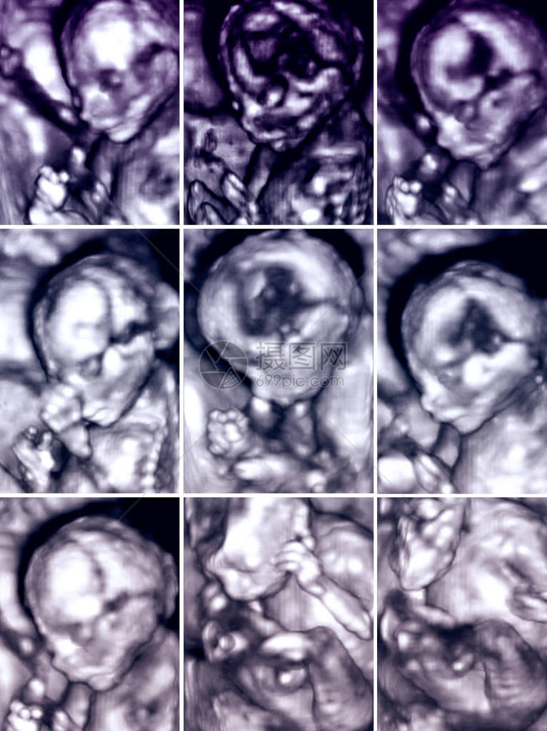 系列九张3D胎儿超图片
