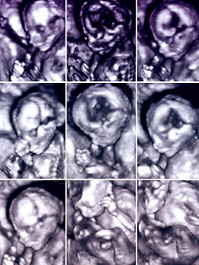 系列九张3D胎儿超图片