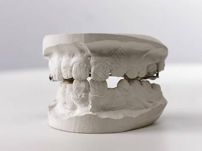 灰牙科假牙显人体胶囊模型TethTeet图片