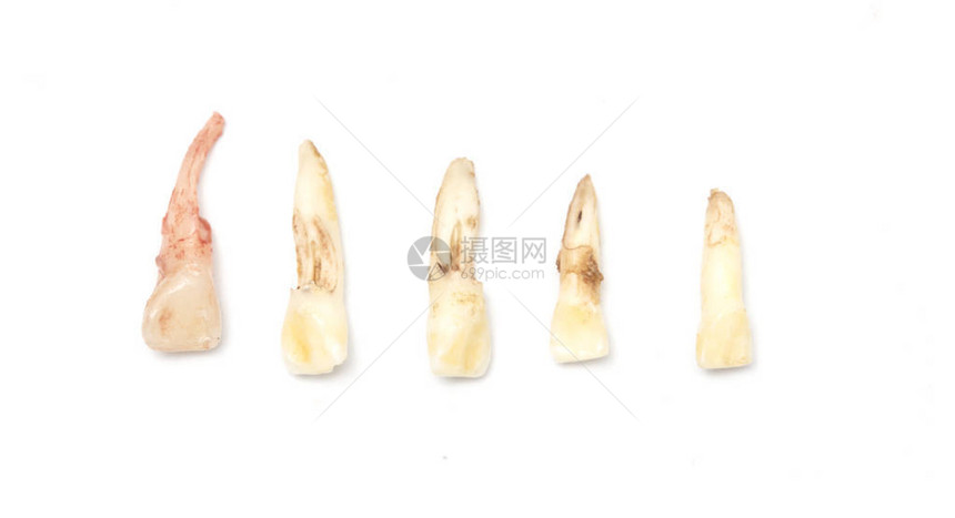乳牙婴儿牙或主牙的脱落在白种图片