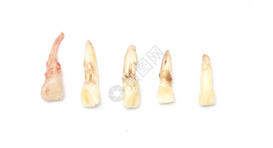 乳牙婴儿牙或主牙的脱落在白种背景图片
