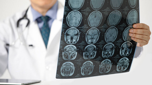 一位坐在桌子上看病人脑部核磁共振扫描的医生有选择地集中关图片