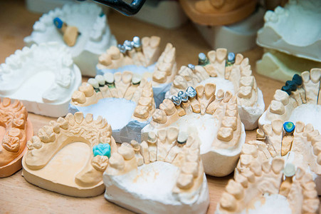 牙医用石膏做成牙齿植入假肢背景图片