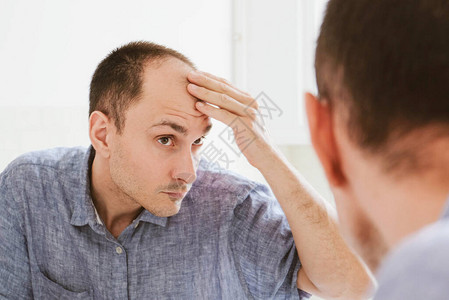男型脱发问题概念年轻的白种人看着镜子担心秃顶男背景图片