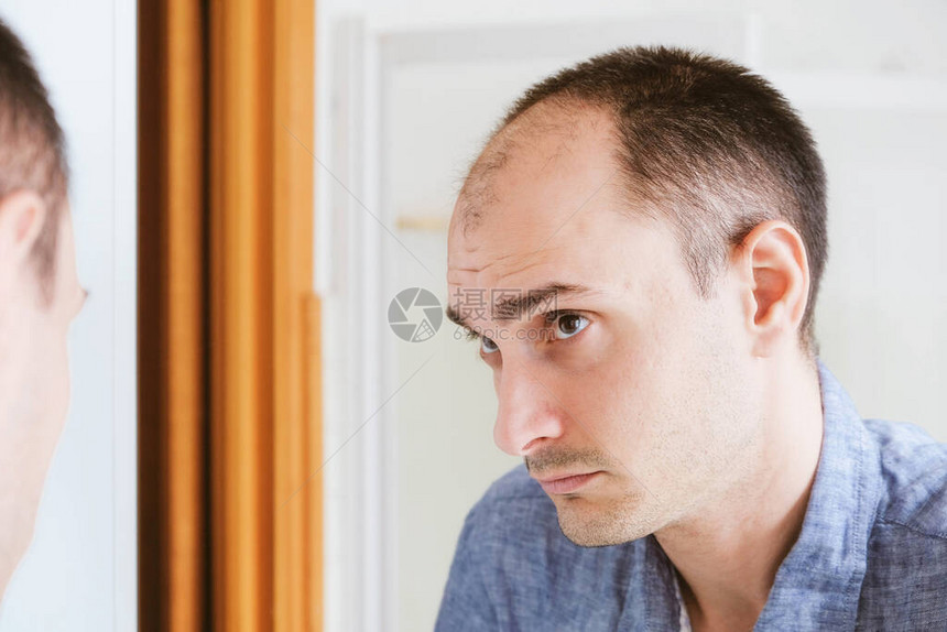 男型脱发问题概念年轻的白种人看着镜子担心秃顶男图片