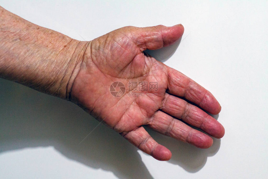 人类皮肤老化的过程一位活了90至100岁的老人的手起皱图片
