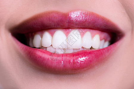 大笑的女人嘴里有大牙齿漂白后的完美笑容牙齿护理和美白牙齿健康的微笑图片