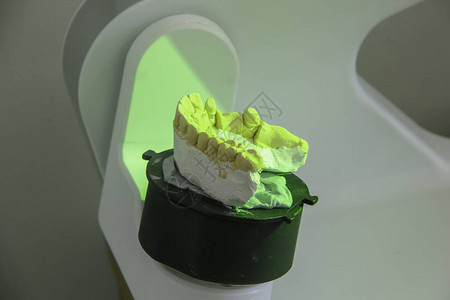 牙科修复术的现代技术用于制造修复体的3d扫描仪上的图片