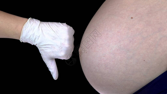 医生抚摸孕妇的肚子并表现出不喜欢图片