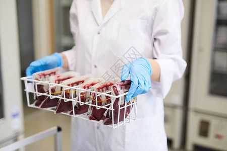 检查在实验室工作的包件中装有血样的防护手套箱和血图片