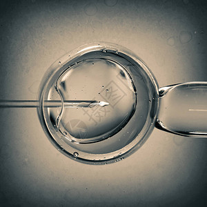 用于人工授精或体外受精的带有针头和精子的卵子人工授精或生育治疗背景图片