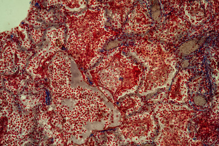 200x显微镜下的肺组背景图片