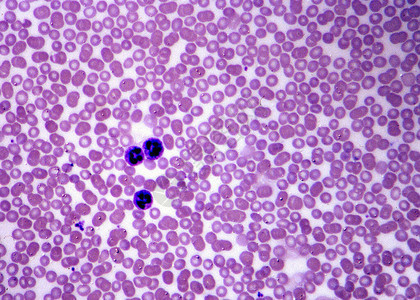 用红血细胞和白血细胞背景图片