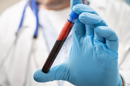 一位医生持有假冒的试管血液样本可图片