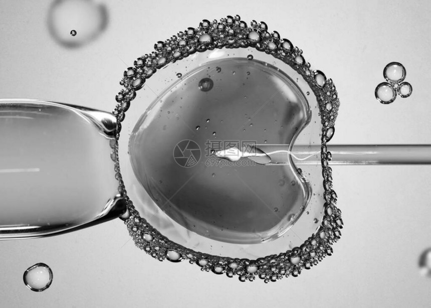 用于人工授精或体外受精的带有针头和精子的卵子人工授精或生育治疗图片