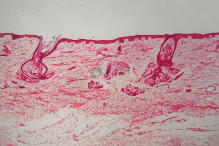 显微镜下有毛囊的皮肤图片