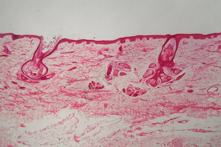 显微镜下有毛囊的皮肤图片