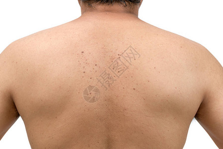 关闭皮肤或白背景被隔离的背部男子身上的血图片