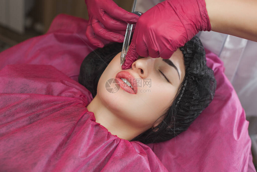 美容院的丰唇程序美容师注射透明质酸以增强双唇美图片