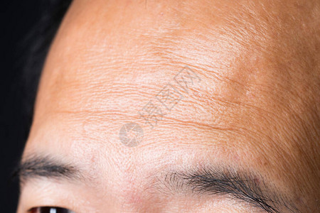 亚洲皮肤的身体部分前额在脸上特写图片