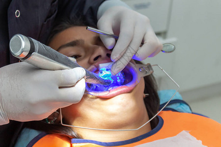 牙科治疗用括号法纠正牙齿生长的图片