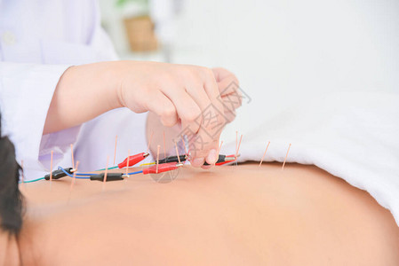 亚裔妇女背部使用电动刺激器接受针刺手术图片