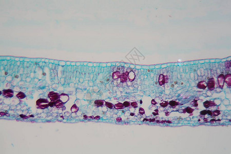显微镜下表皮和叶绿体受损的植物叶片细胞损害是图片